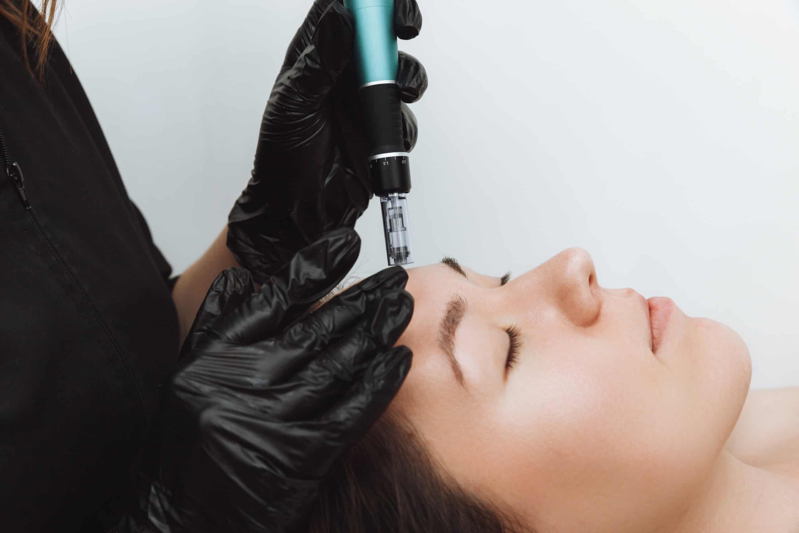 Dermal fillers in Guelph