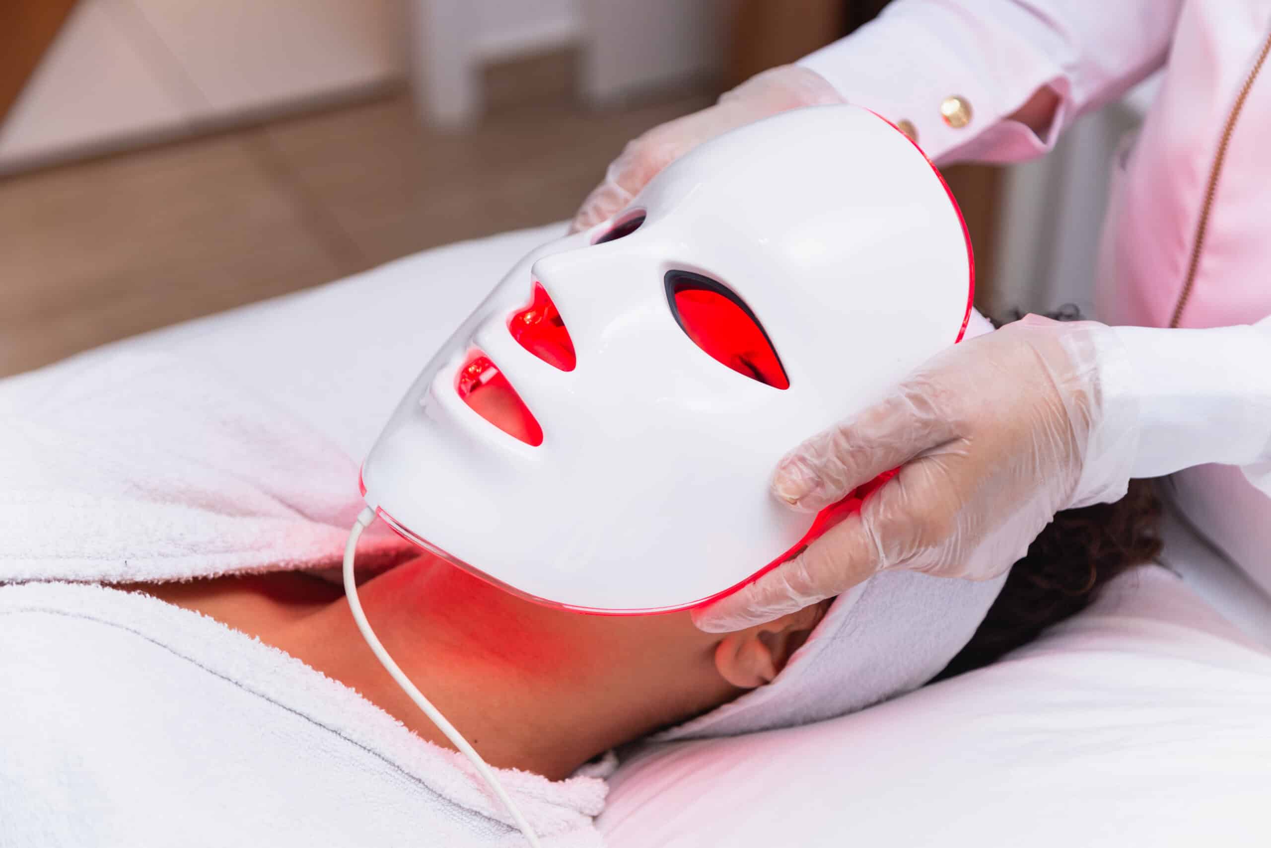 co2 laser Guelph Ontario