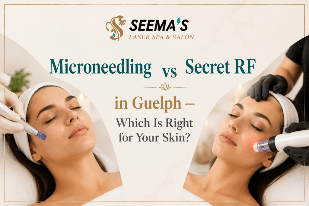 Microneedling vs Secret RF in Guelph