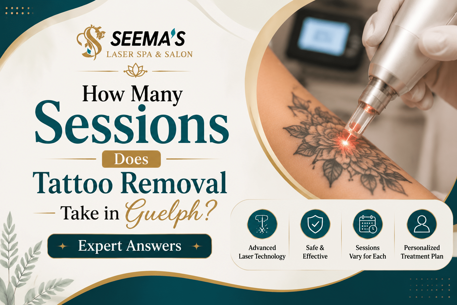 laser tattoo removal