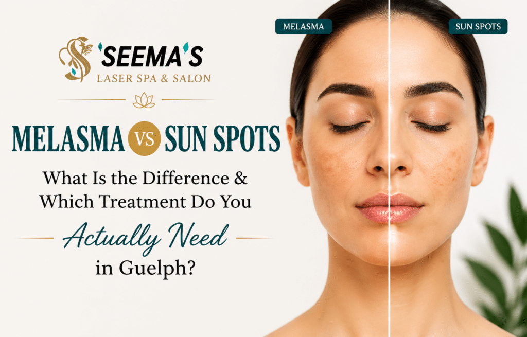 Melasma vs Sun Spots — What Is the Difference & Which Treatment Do You Actually Need in Guelph?